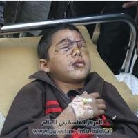Раненый палестинский ребенок